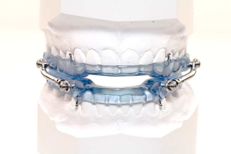 Oral Appliance for sleep apnea in saint john